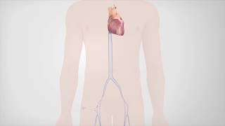 Radiofrequency Catheter Ablation [upl. by Remliw]