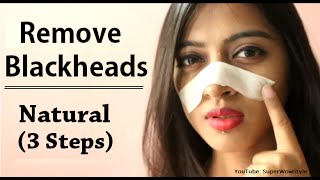 How to Remove Blackheads From Nose amp Face  Naturally at Home  Superwowstyle [upl. by Staley]