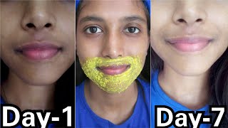 Remove Pigmentation Dark patches Around Mouth  100 Result in 3 Use [upl. by Hyatt]