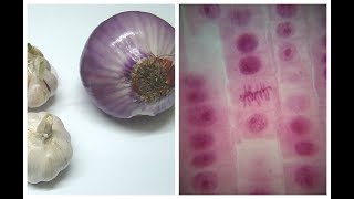 Mitosis in Onion Root tip Experiment [upl. by Merralee]