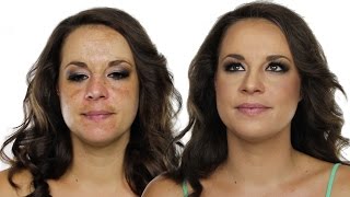 How To Cover Hyperpigmentation  Skin Pigmentation Using MakeUp  Shonagh Scott  ShowMe MakeUp [upl. by Linc79]