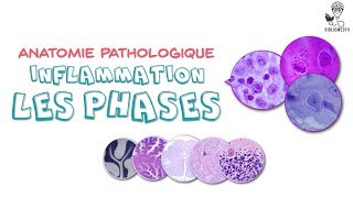 Anatomie Pathologique  Phases de lInflammation [upl. by Laban]