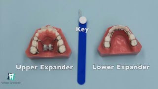 How to Turn an Expander [upl. by Mailand483]