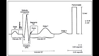 Aprenda a ler um Eletrocardiograma ECG [upl. by Ogeid]