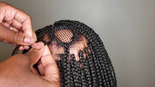 Box Braids Alopecia IGirenesbraids [upl. by Oznofla]