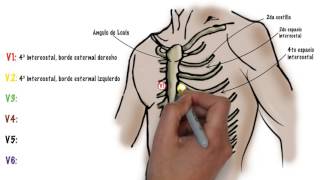 Como hacer un ECG electrocardiograma [upl. by Adnat]