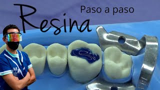 Como hacer una resina dental paso a paso [upl. by Bergmann168]