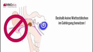 Ohrenschmalz  5 häufige Fragen aus der HNO Praxis [upl. by Otho]