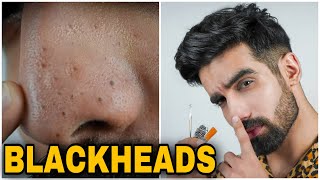 How To Remove BLACKHEADS at HomeEASY amp NATURALSkincare routineLarge Blackhead extraction Hindi [upl. by Viki]