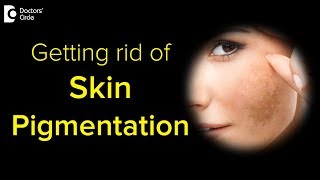 What causes skin pigmentation and how to get rid of it [upl. by Reinald]