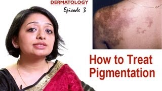 How to Treat Skin Pigmentation Episode 3 [upl. by Midis]