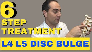 6 Step L4 L5 Disc Bulge Treatment L4 L5 Bulging Disc Treatment by Dr Walter Salubro [upl. by Setiram560]