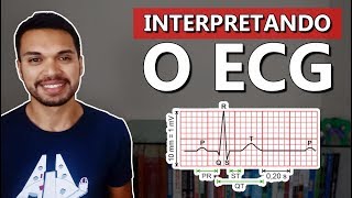 ONDAS DO ECG Cardio 06 [upl. by Salina204]