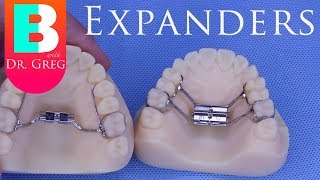 BRACES EXPLAINED Palatal Expanders [upl. by Malloy812]