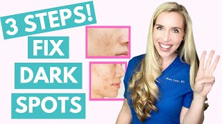 Fix Your Dark Spots in 3 Steps  Hyperpigmentation  Melasma  Skincare Made Simple [upl. by Okimat7]