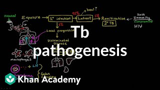 TB pathogenesis  Infectious diseases  NCLEXRN  Khan Academy [upl. by Adnilrem]