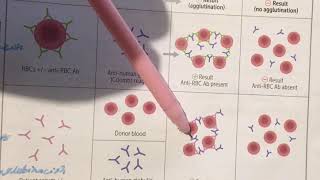 Prueba de Coombs Directo e Indirecto Hematología [upl. by Etat]