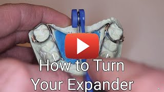 How to Turn Your Expander [upl. by Nancy]