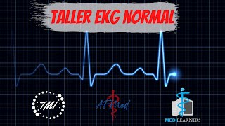 Taller Electrocardiograma Normal [upl. by Esaertal]