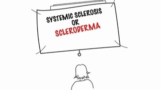 Understanding Systemic Sclerosis [upl. by Elram]