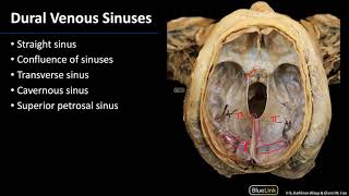 Cranial Cavity and Brain  Dural Venous Sinuses [upl. by Suruat]