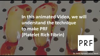 How to make PRF Animated video [upl. by Zachary]