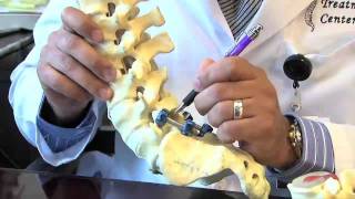 Surgical Procedures  Lumbar Laminectomy amp Discectomy [upl. by Russia]