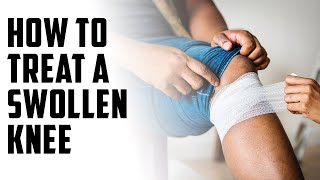 How to treat a swollen knee A Episode 117 [upl. by Salahi]