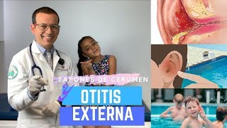 TAPON DE CERUMEN COMO CAUSA DE OTITIS EXTERNA [upl. by Vikki784]