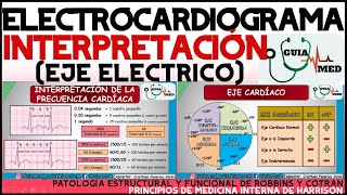 ELECTROCARDIOGRAMA INTERPRETACIÓN  GuiaMed [upl. by Ynafetse]