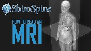 How to read an MRI [upl. by Yatnoed]