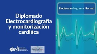 Electrocardiograma normal [upl. by Champagne]