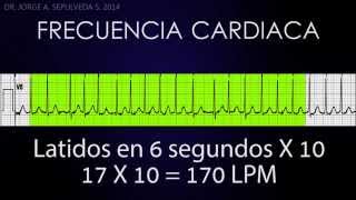 Electrocardiografía Básica Parte 24 [upl. by Teiv780]