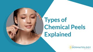 Types of Chemical Peels  Peels for Hyperpigmentation amp Acne [upl. by Haymes310]