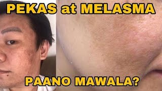 Pinoy MD Labis na pamamantal sanhi ng urticaria [upl. by Saw347]