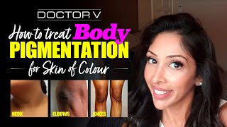 Doctor V  How To Treat Body Pigmentation For Skin Of Colour  Brown Or Black Skin [upl. by Eseerehs84]