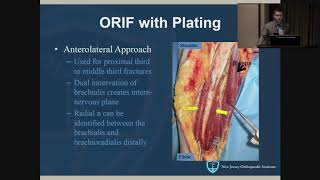 Humeral Shaft Fractures  John Callaghan MD [upl. by Vinaya310]