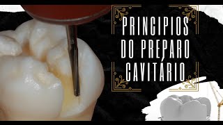 Princípios do Preparo Cavitário [upl. by Lleihsad401]